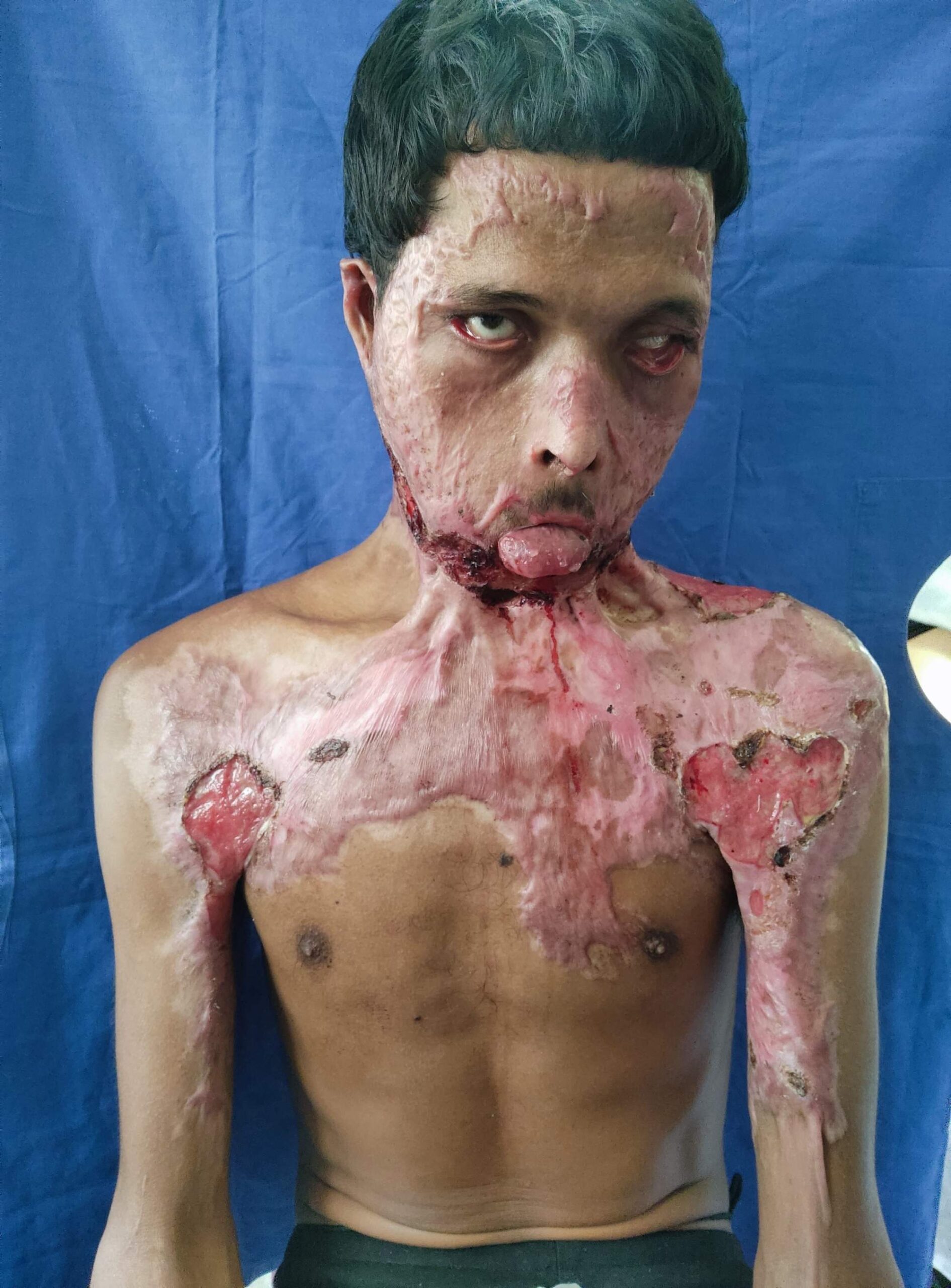 {{brizy_dc_image_alt imageSrc=