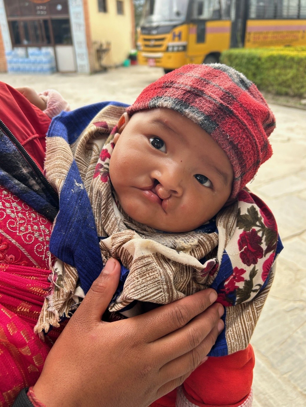 {{brizy_dc_image_alt imageSrc=